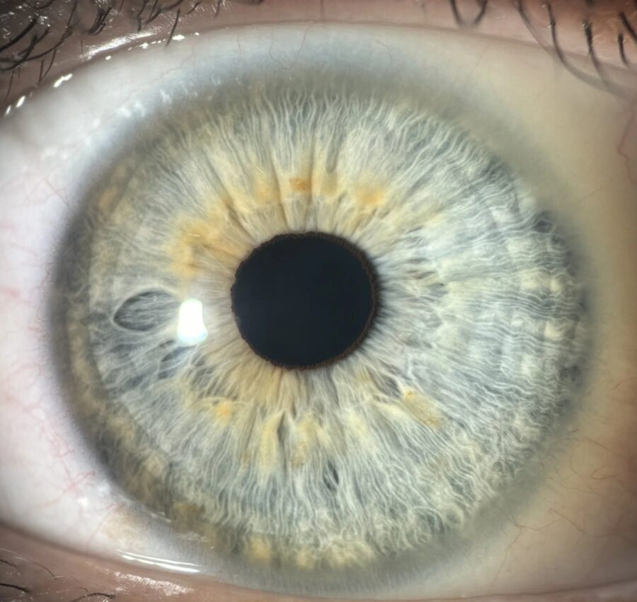Macrophotographie d'un iris en gros plan — cabinet du Dr Alexandre HAGE