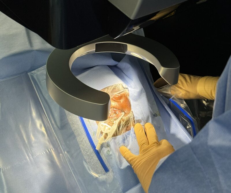 Bras articulé d'un laser excimère 193 nm en cours de procédure de photokératectomie au cabinet du Dr Hage